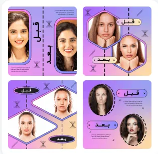 قبل از خرید پکیج قالب پست اینستاگرام بخوانید